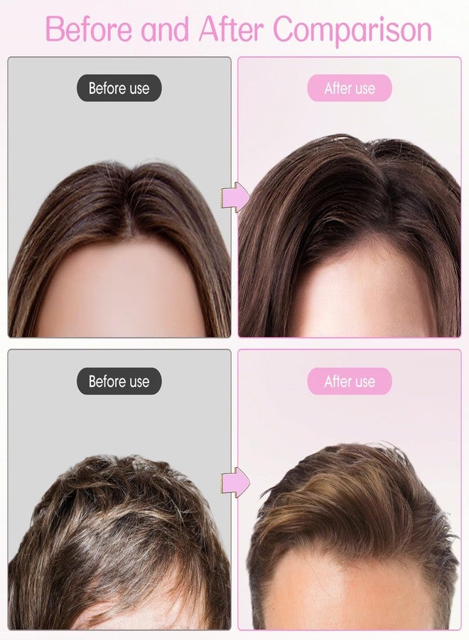 JANFUN Volumizing Hair Clips for Women 2PCS, Hair Volume Clip Styling Tools Volumizing Comb for Fluffy Bangs Clips for Root Lift, Root Booster Clips - Image 5